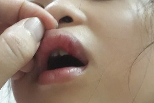 Bàn giao hồ sơ cho Công an làm rõ có hay không việc cô giáo Hà Nội đánh học sinh dập môi