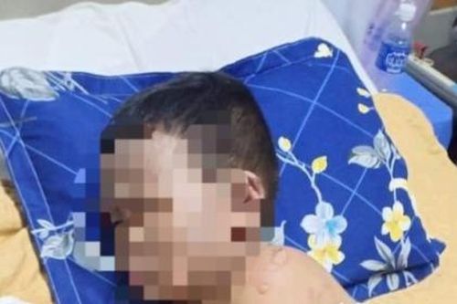Bắt giữ 4 nghi can trong vụ ném bom xăng làm 2 cháu bé bỏng nặng
