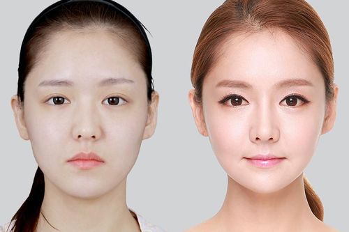Định hình khuôn mặt Mewing: 'Hô biến' cho khuôn mặt sắc nét không cần dao kéo?