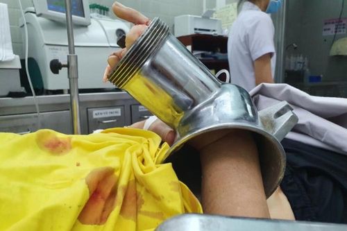 Bị máy cuốn nát bàn tay khi đang xay thịt nấu ăn