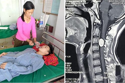 Hãy cứu chàng trai 17 tuổi có khối u cột sống cổ