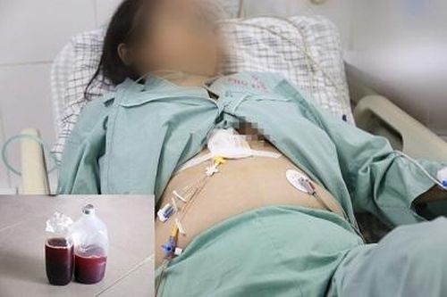 Hút 1 lít dịch đỏ không đông vì tràn dịch màng tim ở người phụ nữ 54 tuổi