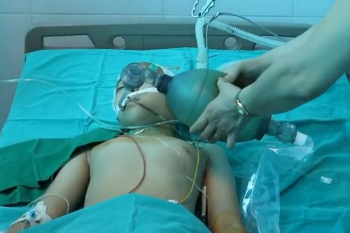 Bác sĩ Bệnh viện Nhi TW 'tốc hành' về Thái Bình tham gia cứu bé gái 10 tuổi