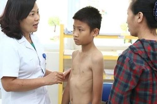 Nhiều bệnh nhi mắc dị tật bẩm sinh được phát hiện nhờ khám miễn phí