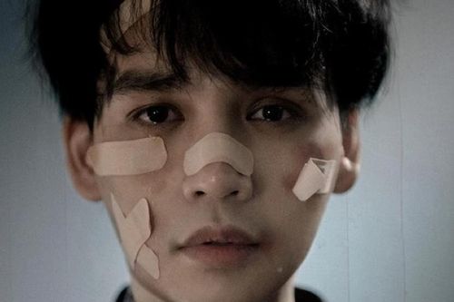 Nguyễn Trần Trung Quân gây sốc với poster đầy thương tích, tên bài hát đầy ai oán