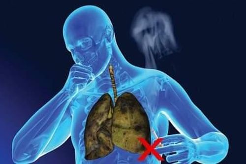 Bệnh tật đầy người vì hút thuốc lá, hãy bỏ thuốc ngay hôm nay