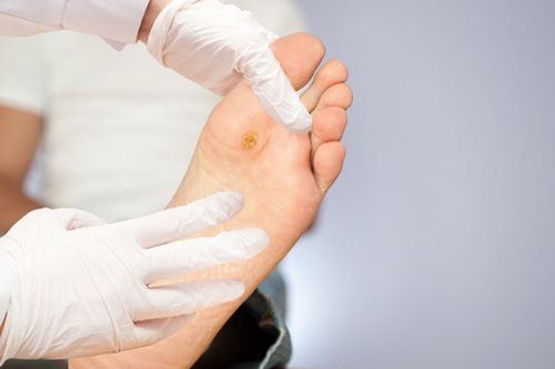30 giây có thể mất 1 chân: Bạn cần nhớ điều này khi bị tiểu đường