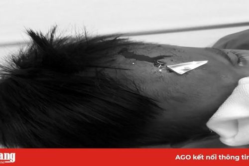 Ca mổ cấp cứu hy hữu