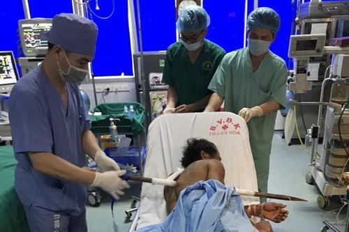 Cứu sống bệnh nhân bị xà beng đâm xuyên ngực