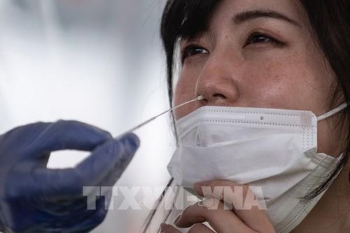 Các doanh nghiệp Nhật Bản 'bắt tay' sản xuất bộ xét nghiệm virus SARS-CoV2