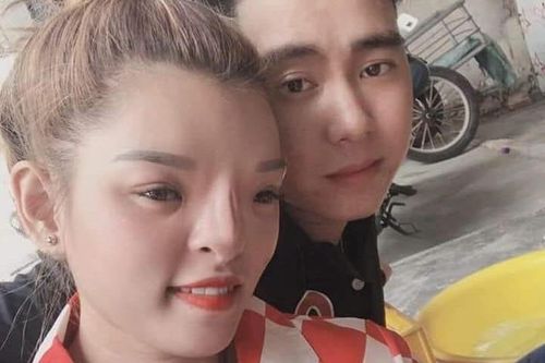 Cô gái có mặt biến dạng và chuyện tình đẹp với bạn trai kém 4 tuổi