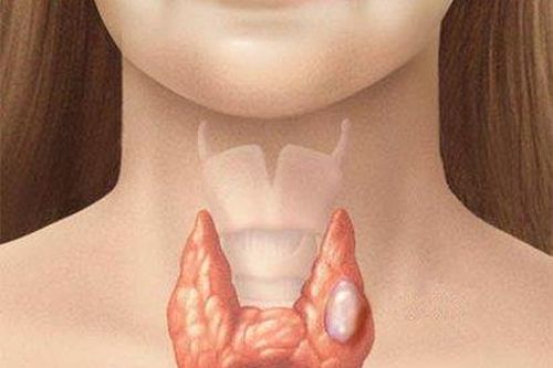 Dấu hiệu ung thư tuyến giáp