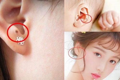 Tướng nốt ruồi ở tai quý như kim cương, ai có được là phúc lộc trọn đời