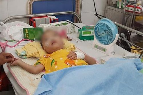 Cháu bé bị tim bẩm sinh, nhồi máu não thoát chết ngoạn mục