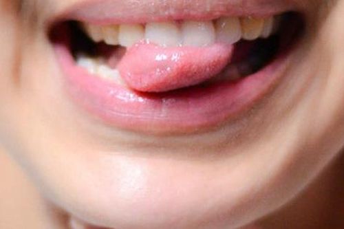 Ai một lần trong đời cũng đã từng cắn nhầm lưỡi, nguyên nhân của việc này sẽ khiến bạn ngã ngửa