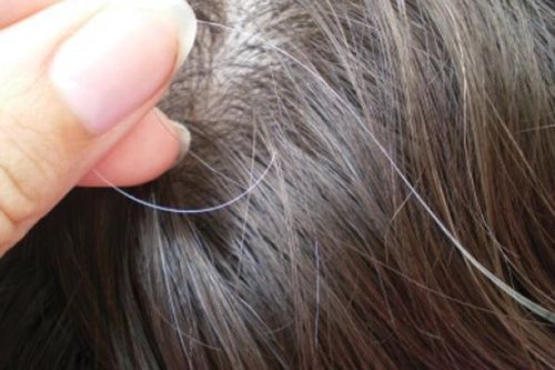 Nỗi lo về tóc sẽ không còn lo ngại với giải pháp này