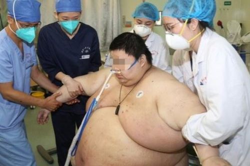 Cầu cứu bác sĩ khi tăng hơn 100 kg sau 5 tháng cách ly