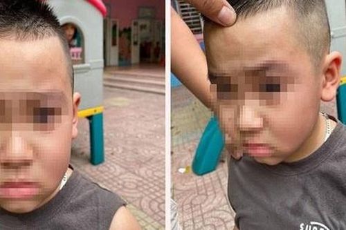 Con học mầm non bị cào cấu, mẹ đến trường tát bạn của con