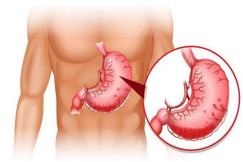 6 bệnh dễ mắc ở nam giới tuổi trung niên