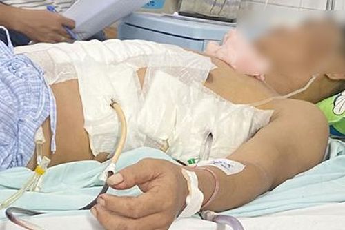 Cứu sống người đàn ông bị đâm thấu ngực