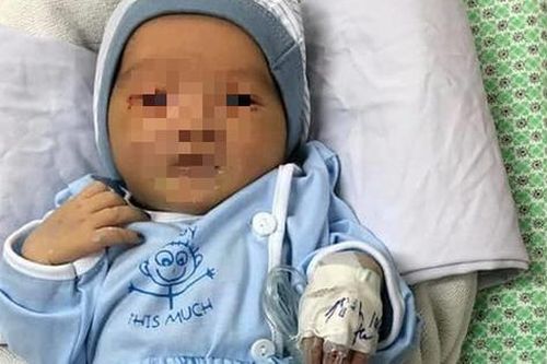 Bị nhiễm trùng máu, bé sơ sinh bị bỏ rơi dưới hố ga ở Hà Nội phải thở máy