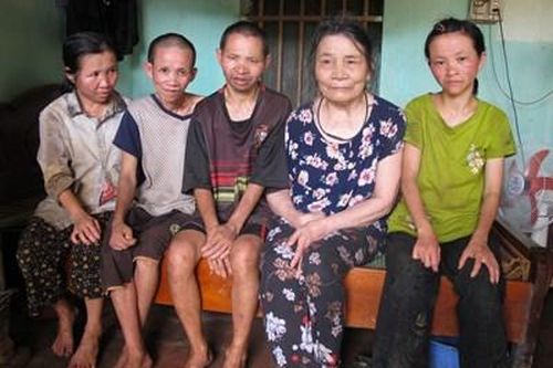 Thương cảnh mẹ già và 4 người con dị tật là nạn nhân chất độc da cam