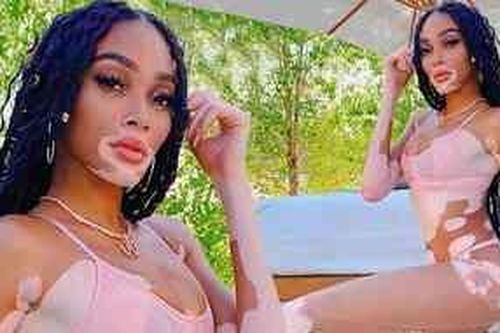 Winnie Harlow thư giãn bên hồ bơi với bikini nhỏ xíu
