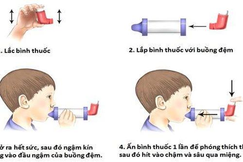 Cách sử dụng bình hít định liều với buồng đệm trong bệnh hen phế quản trẻ em