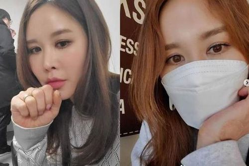 Nữ ca sĩ Hàn Quốc không thể đeo khẩu trang vì biến chứng thẩm mỹ