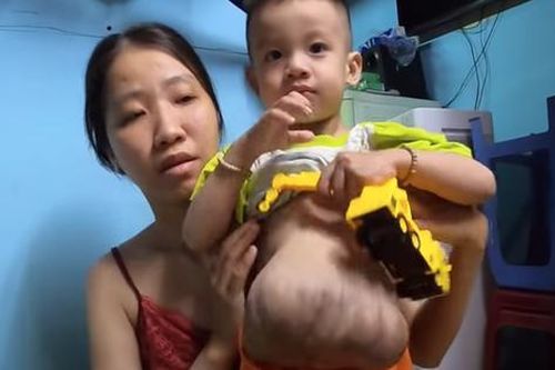 Xót thương cậu bé có tim, ruột, gan... 'lạc' bên ngoài cơ thể