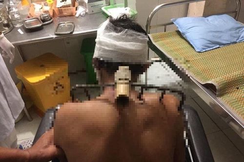 Chưa có cơm ăn, con trai bổ bồ cào vào vai cha