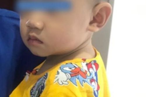 Tai nạn kinh hoàng: Mẹ đi pha sữa cho bú, bé trai 10 tháng tuổi bò xuống gầm bàn nuốt mảnh gương vỡ vào bụng