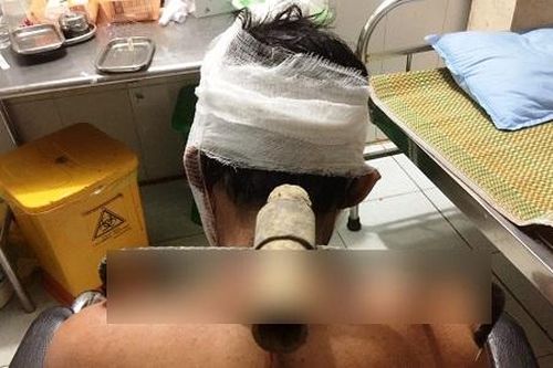 Thái Nguyên: Mâu thuẫn, con trai dùng bồ cào bổ vào vai bố