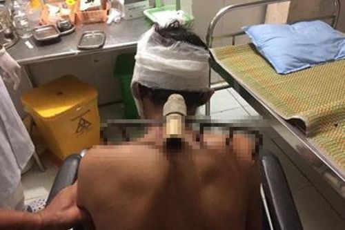 Kinh hãi con trai bổ bồ cào vào bố