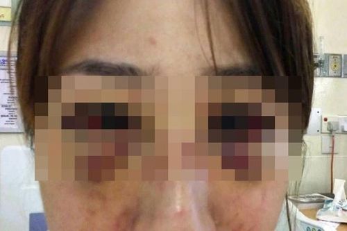 Bác sĩ bị tù 3 năm, phạt 4 roi và gần 3.000 USD vì hành hung bạn gái