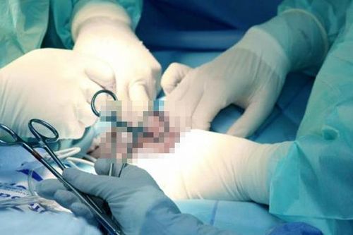 2 quý ông phải cắt cụt 'cậu nhỏ' vì chủ quan