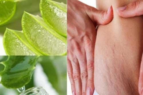 Mẹ bỉm sữa sau sinh nhớ bỏ túi ngay 'bí kíp' này xóa tan vết rạn da, bụng phẳng lì chỉ sau 1 tuần