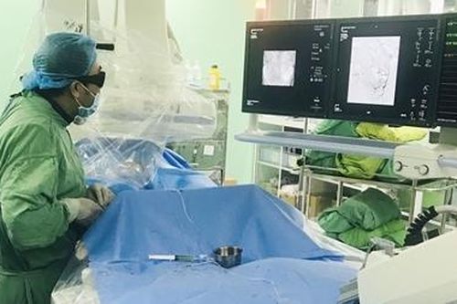 Lần đầu tiên điều trị tăng sinh tiền liệt tuyến không cần phẫu thuật