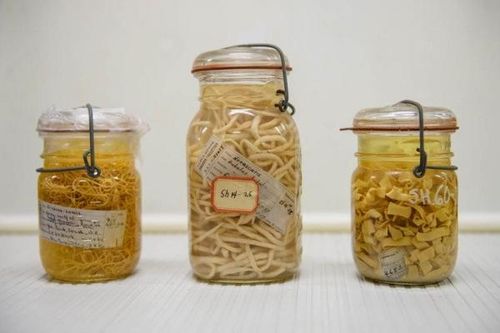 Choáng với ổ ký sinh trùng tỷ con ẩn nấp trong ruột của bạn