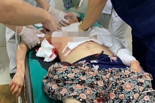Chồng truy sát 3 người gia đình vợ rồi tự tử