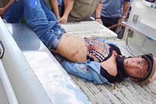 Hai cậu cháu bị đâm trọng thương khi đuổi bắt nhóm trộm xe SH