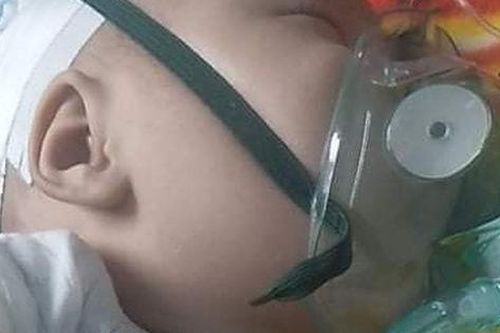 Bé trai hơn 4 tháng nguy kịch sự sống vì teo thực quản khi bố mẹ quá nghèo