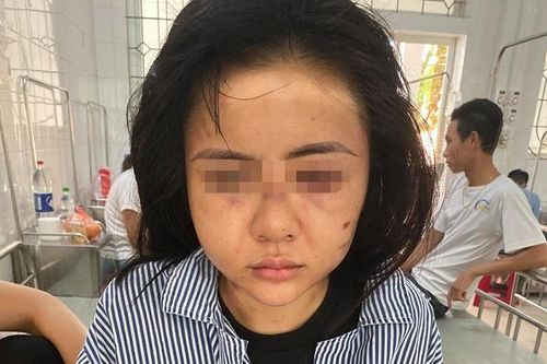 Khởi tố kẻ hành hung cô gái suốt 2 giờ