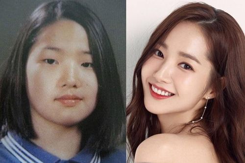 Tại sao Hàn Quốc là điểm đến trong mơ để phẫu thuật thẩm mỹ?