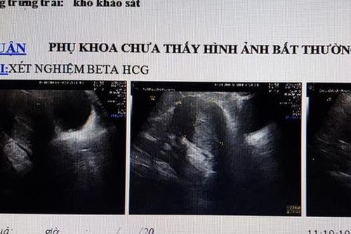 Bác sĩ sản khoa nói gì về trường hợp vác bụng bầu đi đẻ nhưng thực chất không hề có thai?