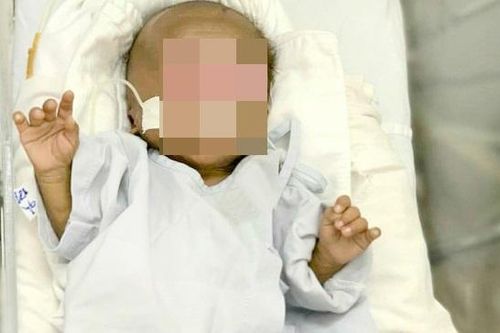 Bà ngoại cắt rốn khiến bé sơ sinh bị uốn ván nguy kịch