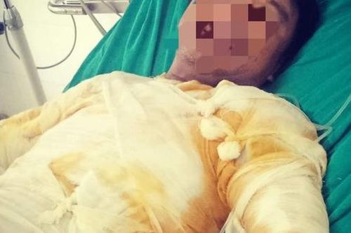 Hà Tĩnh: Sửa sự cố điện, nam công nhân bị điện phóng gây bỏng nặng