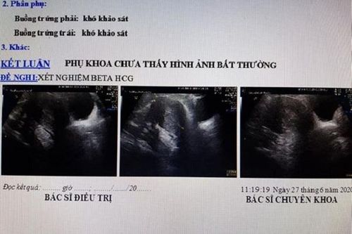Hy hữu, nhập viện chờ sinh, người phụ nữ 'ngã ngửa' khi nhận thông báo