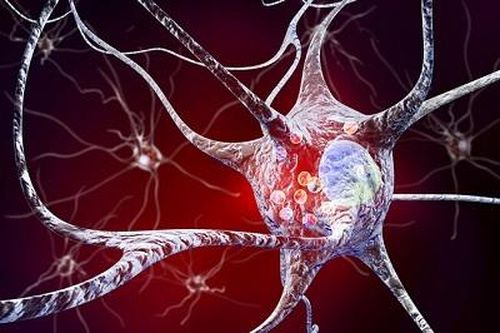 Phương pháp mới có thể chữa dứt điểm bệnh Parkinson