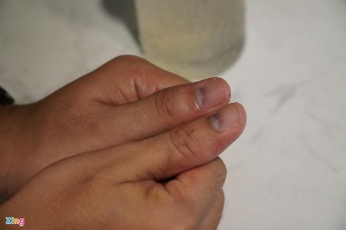 Diễn viên Đức Thịnh: 'Qua 5 bệnh viện mới biết mình bị ung thư'